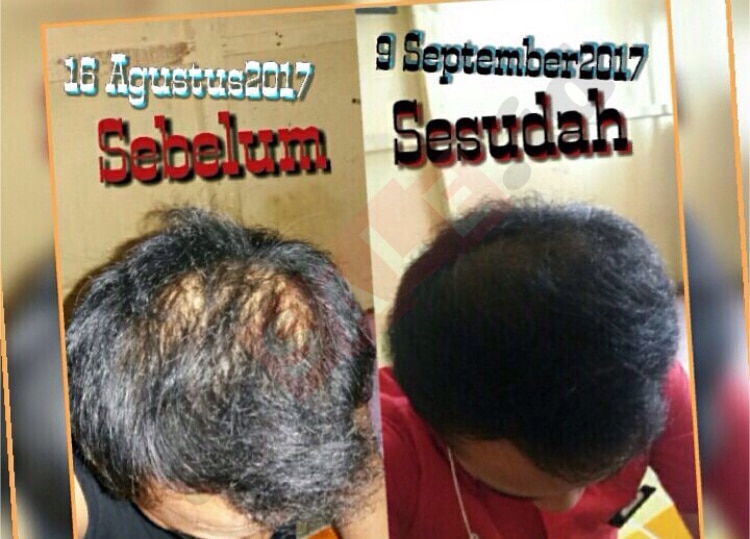akSALE.id
